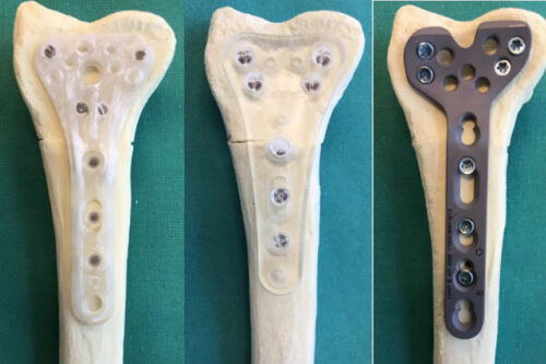 Promising biomechanical data from prototype plate comparison with titanium distal radius plate