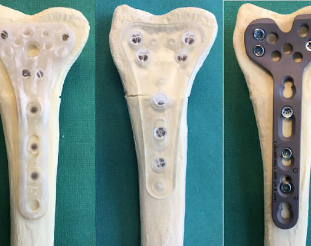 Promising biomechanical data from prototype plate comparison with titanium distal radius plate